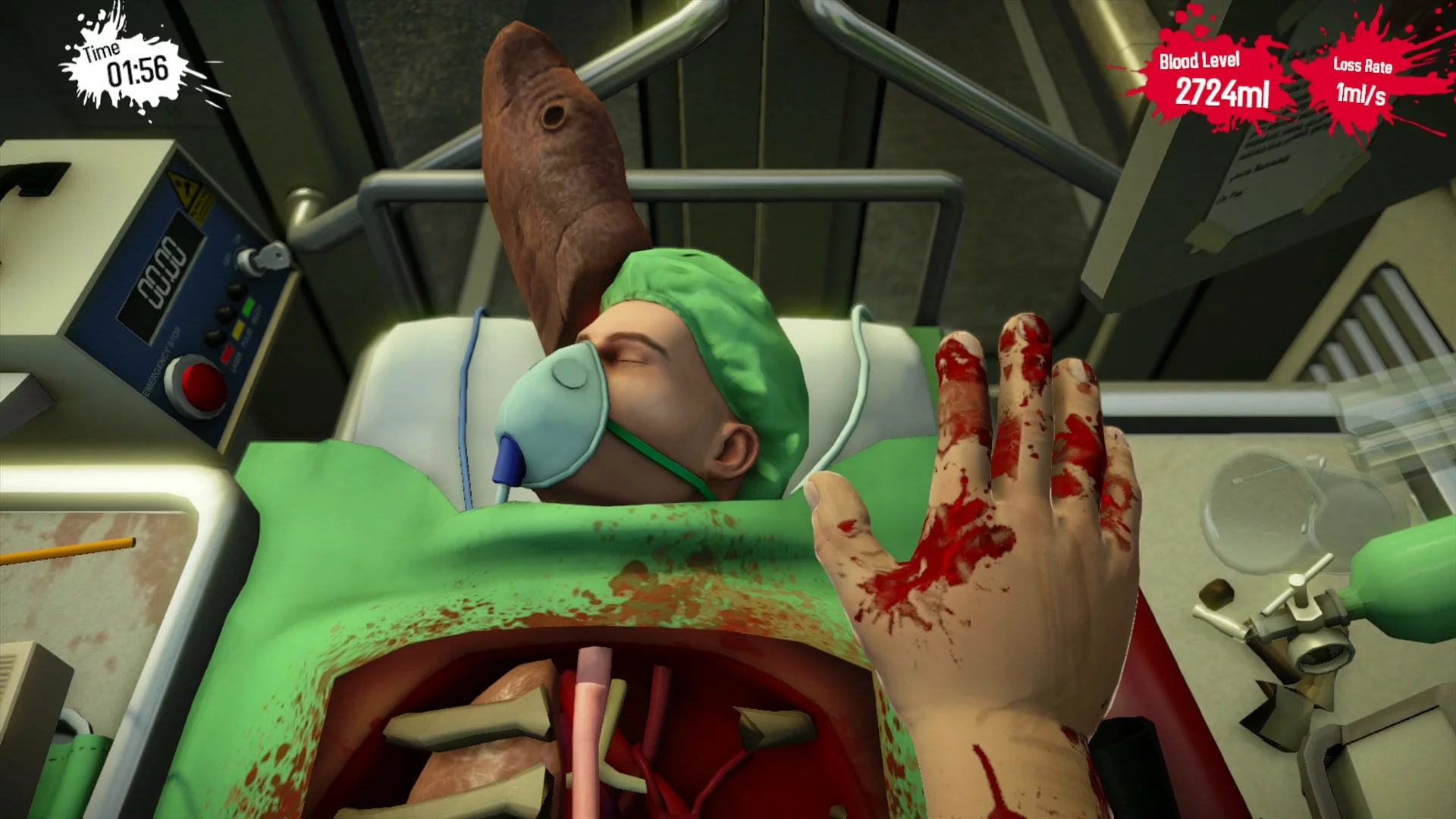 Surgeon Simulator - Anniversary Edition Content DLC Steam CD Key (5.64$)